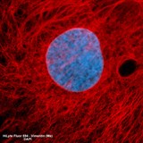 IMG-EN-AS-81271-HiLyte594-Fluorescence-microscopy-02.jpg